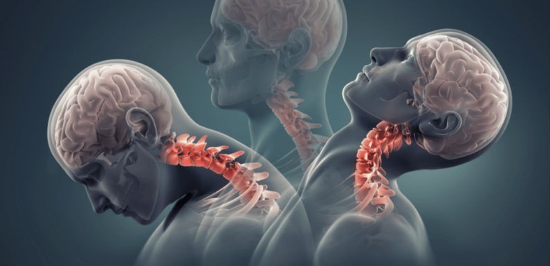 Latigazos cervicales