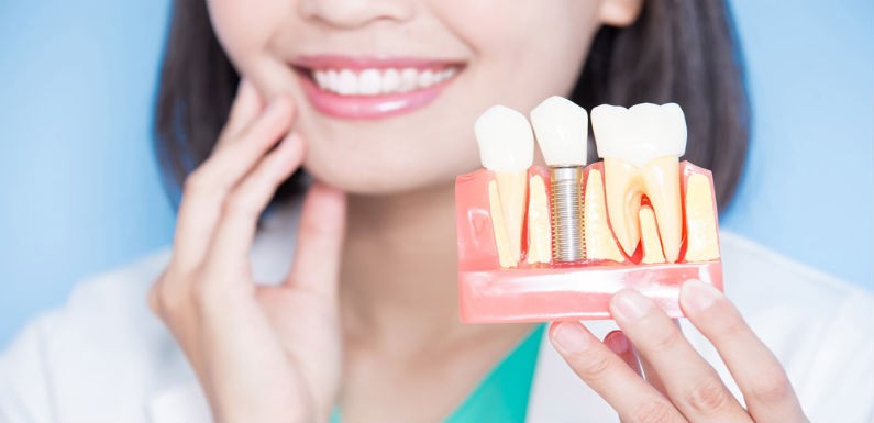 Buen diseño y ajuste de un implante dental